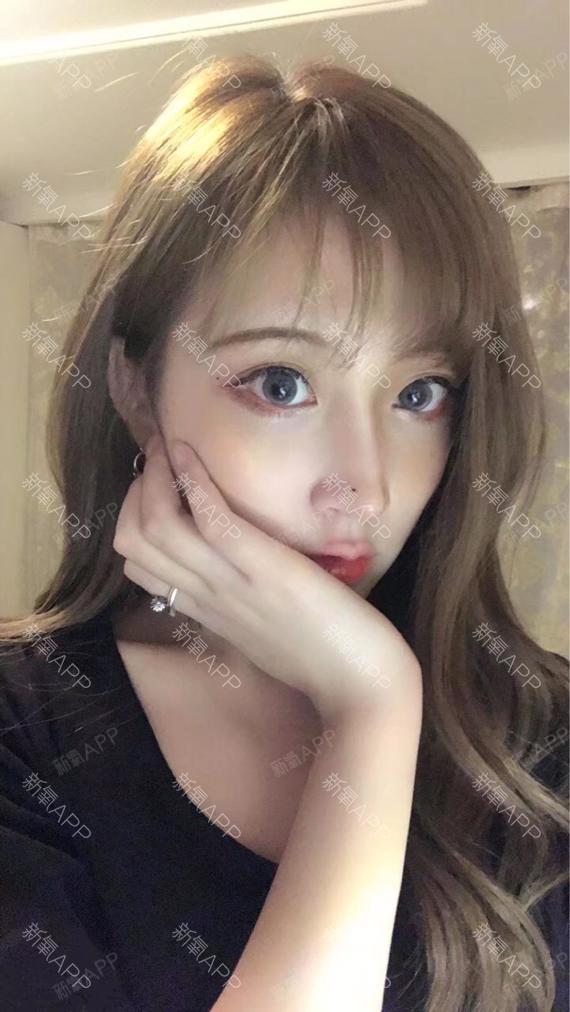 萌萌哒的小狗子玻尿酸隆鼻第13天美丽日记-新