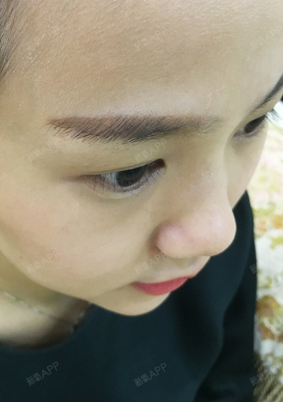 种植眉毛