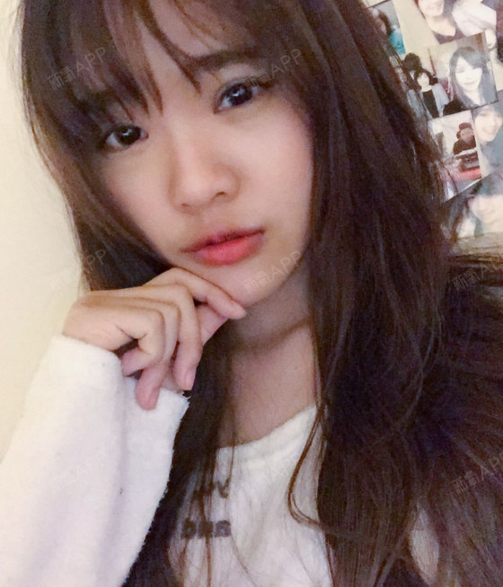 手机不离手的妖切开双眼皮第55天美丽日记-新