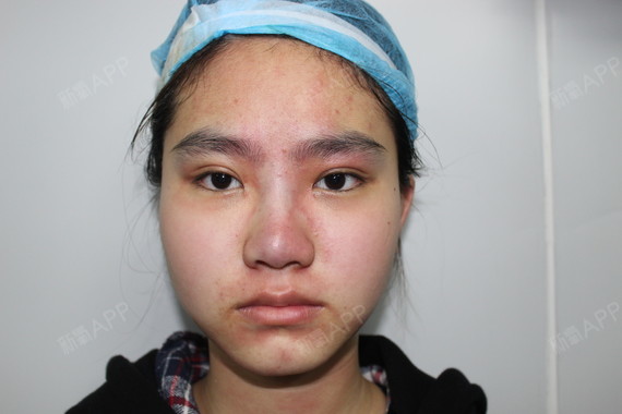 氧气0673921508236624鼻部综合第0天美丽日