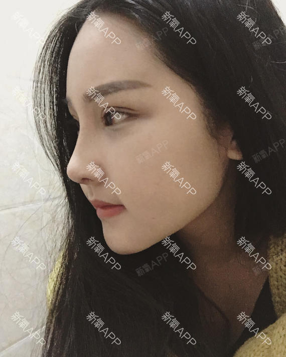 过了很9耳隆鼻游游小鱼第30天美玩法记河里软骨游游复合戏丽日图片