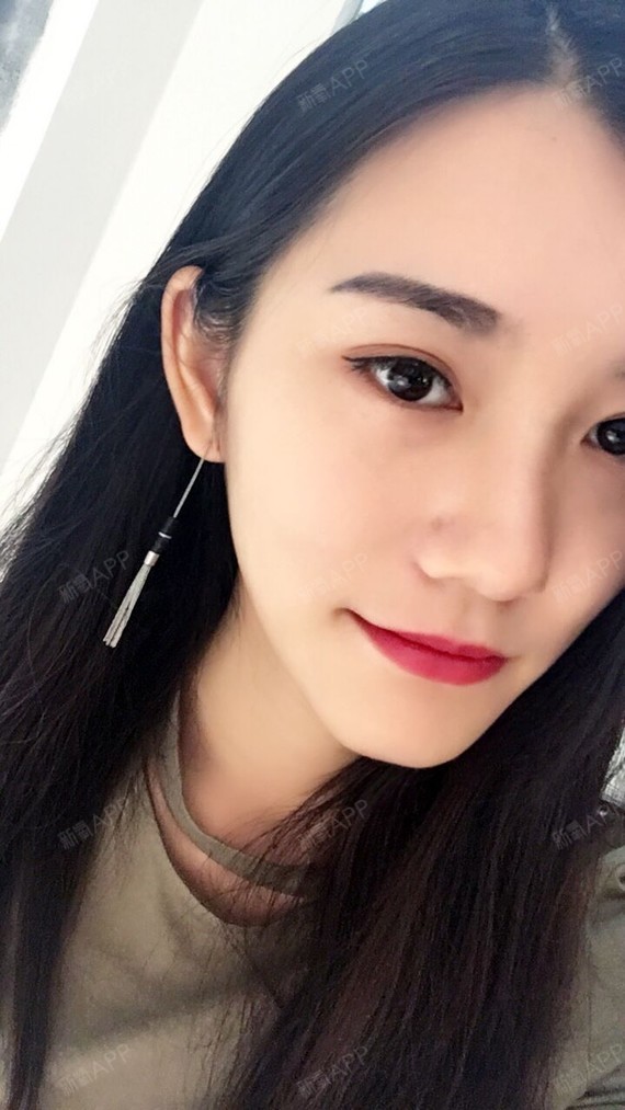切开双眼皮