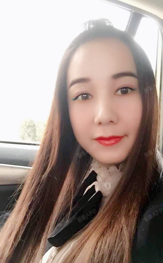 江枫思渺然切开双眼皮第78天美丽日记-新氧美