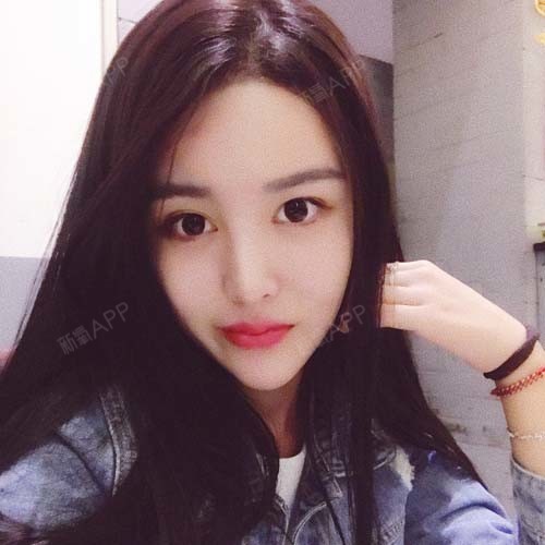 婷婷宝宝永远18种植发际线第47天美丽日记-新