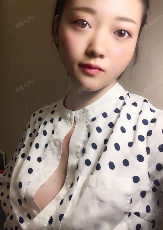 但但要做小仙女假体隆胸第14天美丽日记