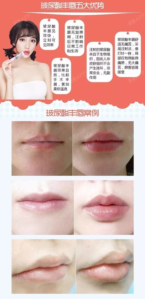 秋冬来了,献上我私藏的去唇纹终极法宝!口_圈子-新氧