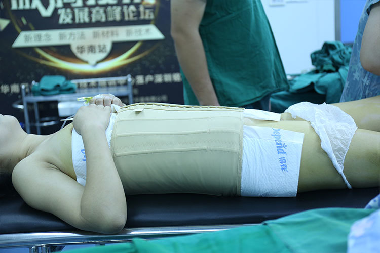 医生说抽脂后穿着合适压力的塑身衣是十