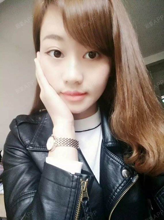 is追逐梦的孩子鼻综合第33天美丽日记-新氧美