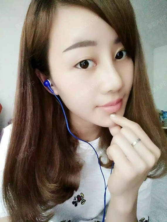 is追逐梦的孩子鼻综合第33天美丽日记-新氧美