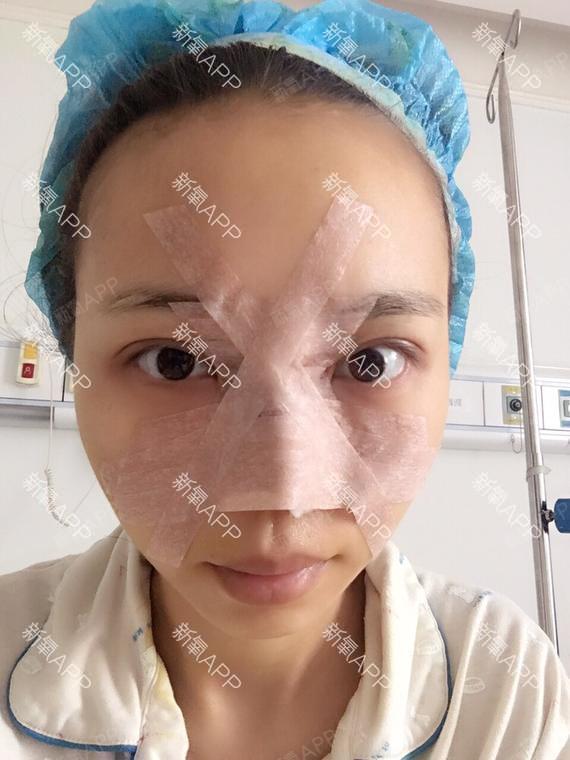 柠檬西柚草鼻综合第0天美丽日记-新氧美容整形