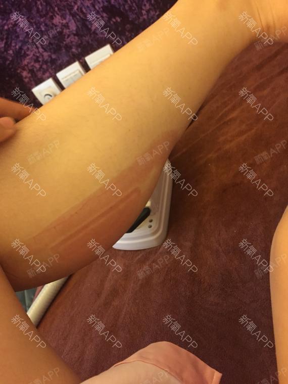 让人沉醉的爱情冷冻溶脂瘦小腿第0天美丽日记