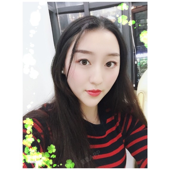 wy柚子多肉玻尿酸垫下巴第77天美丽日记-新氧