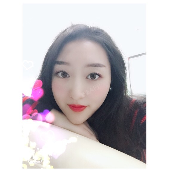 wy柚子多肉玻尿酸垫下巴第77天美丽日记-新氧