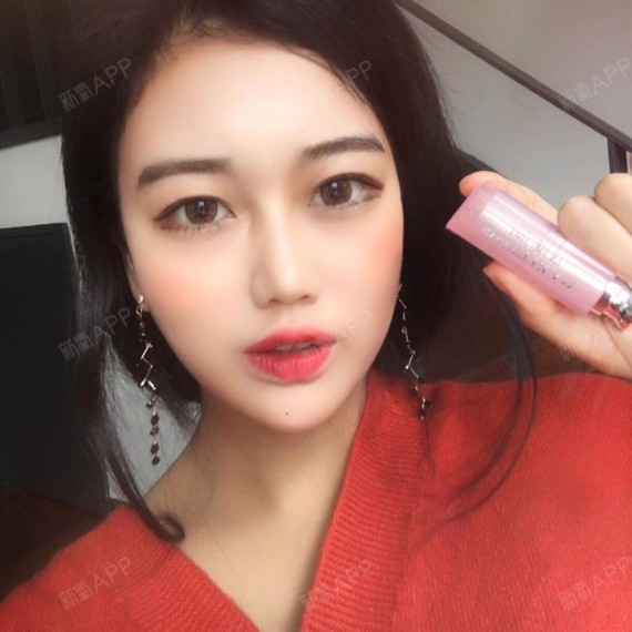 氧气2645511508742164玻尿酸垫下巴第7天美