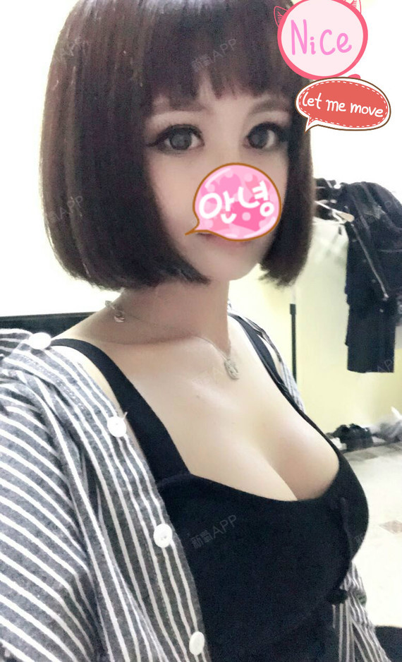 太原丽都整形美容医院假体隆胸第123天美丽日