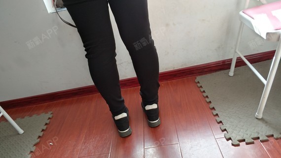 Sandm旧颜肉毒素瘦小腿第34天美丽日记-新氧