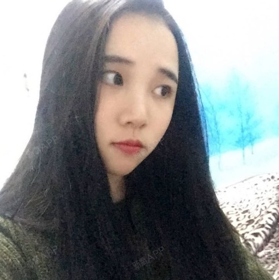 孟玲锋爱玻尿酸垫下巴第1天美丽日记-新氧美容