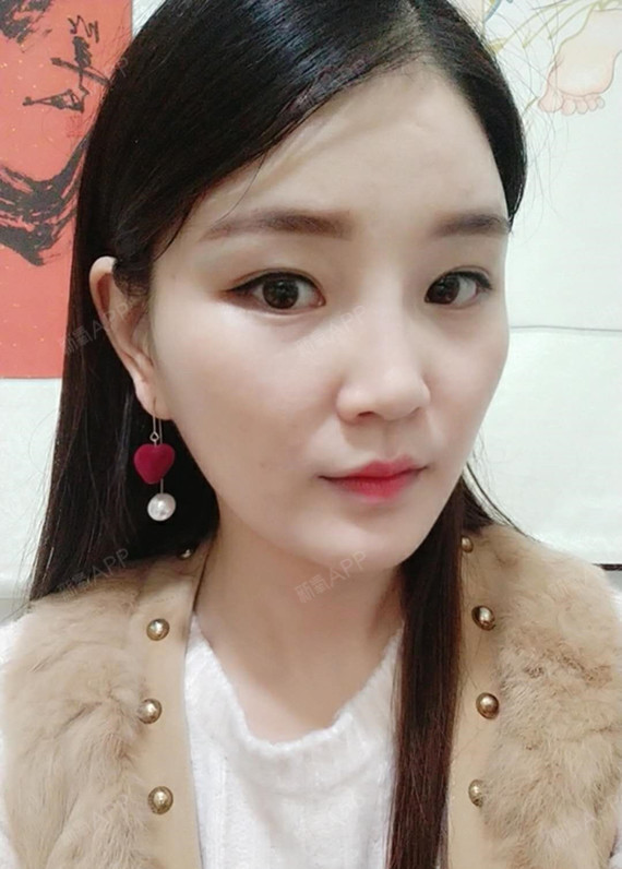 划一个完美的圈光纤溶脂瘦脸第34天美丽日记