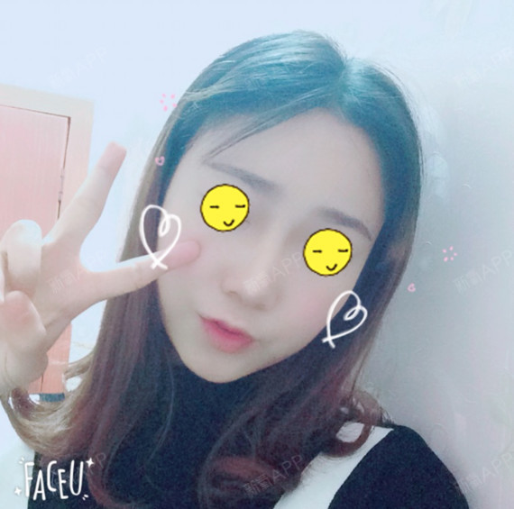 第四人称的鼻综合第68天美丽日记-新氧美容整