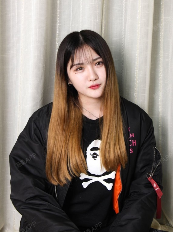 一碗叉烧面部吸脂第20天美丽日记-新氧美容整