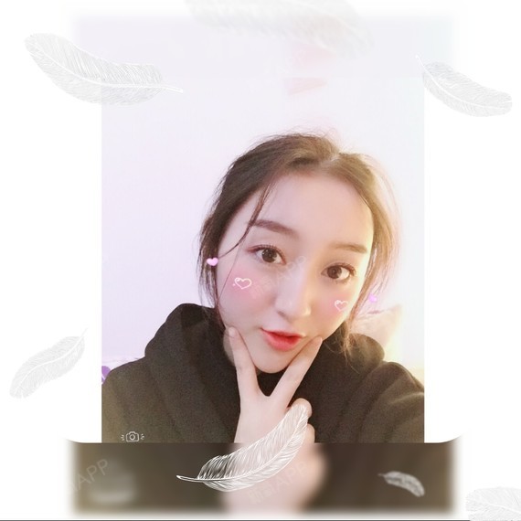 wy柚子多肉玻尿酸垫下巴第93天美丽日记-新氧