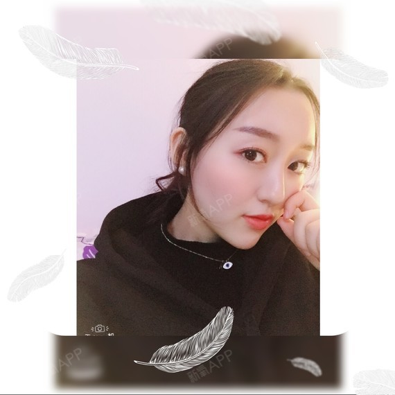 wy柚子多肉玻尿酸垫下巴第93天美丽日记-新氧