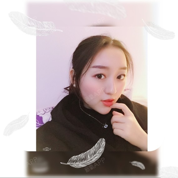 wy柚子多肉玻尿酸垫下巴第93天美丽日记-新氧