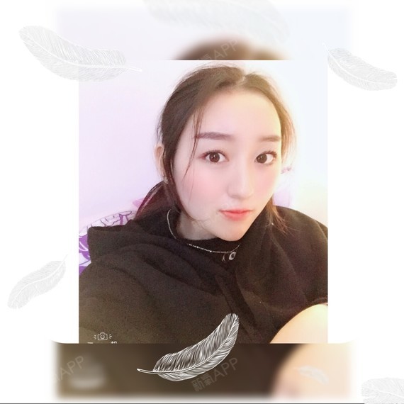 wy柚子多肉玻尿酸垫下巴第93天美丽日记-新氧