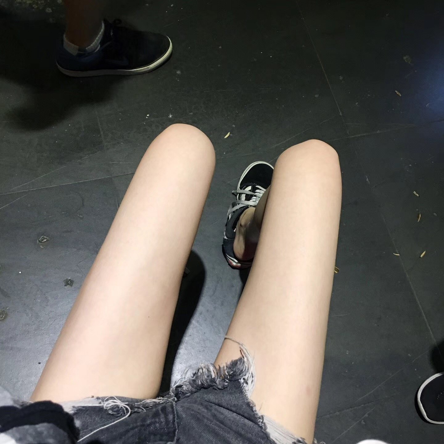 上海微蓝医疗美容吸脂瘦大腿怎么样_恢复过程_效果_区