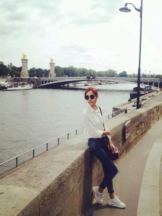 圆圆小丸子开内眼角第16天美丽日记-新氧美容