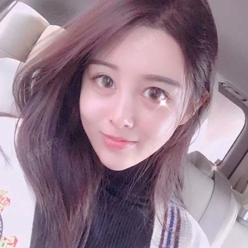 婷婷宝宝永远18种植发际线第60天美丽日记-新