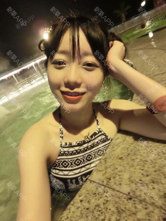 lody甜圈圈切开双眼皮第30天美丽日记-新氧美