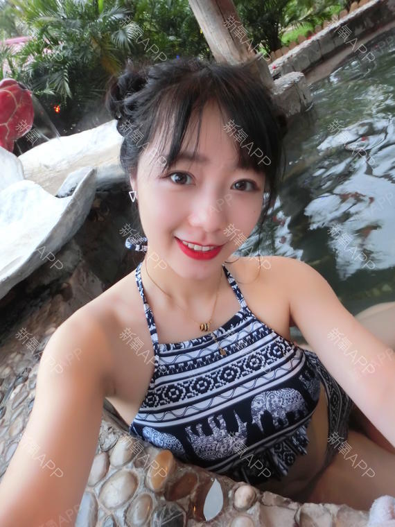 lody甜圈圈切开双眼皮第30天美丽日记-新氧美