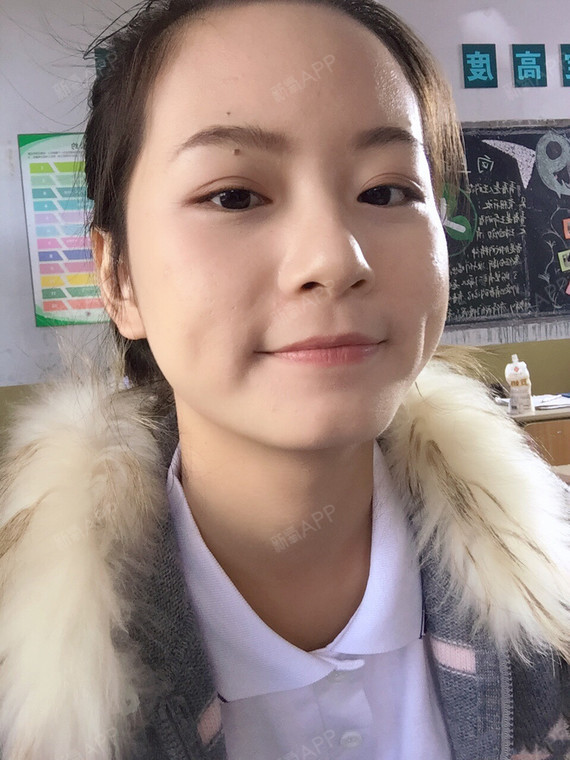 瘦脸呀,拔牙?包针打了瘦脸额头起图片