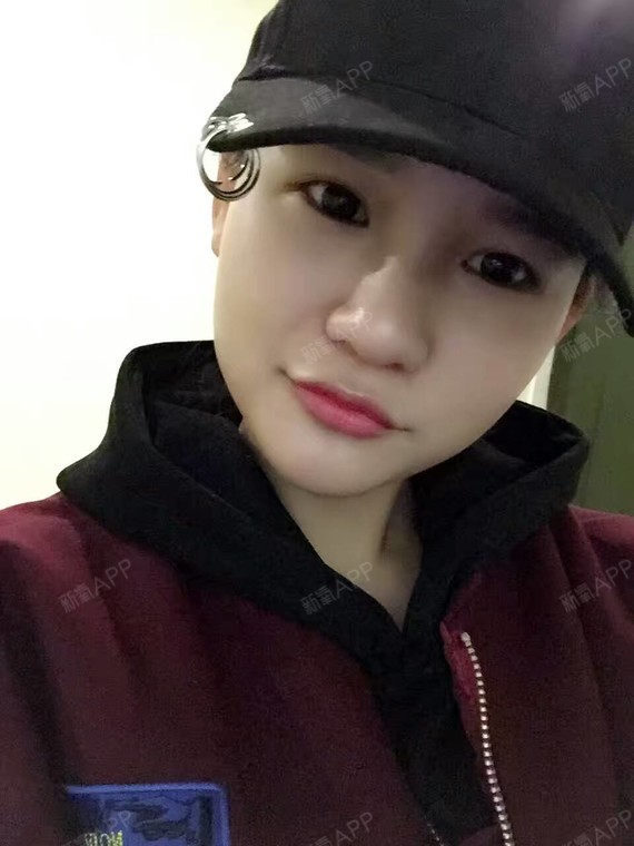 小兔子吃苹果水光针第114天美丽日记-新氧美容