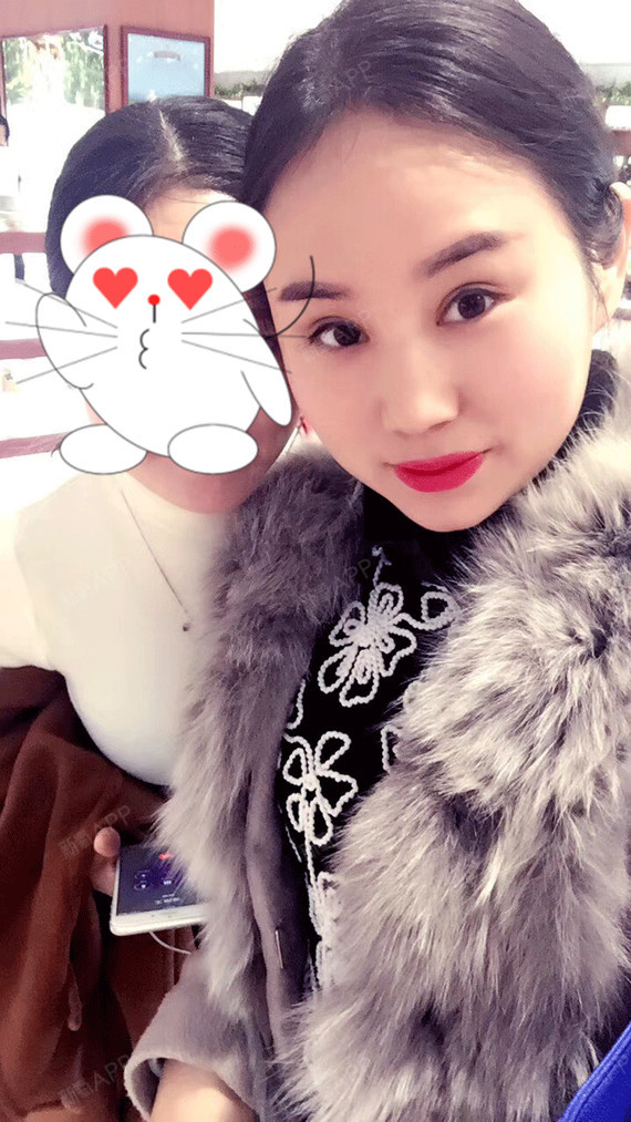 天月偶尔合群切开双眼皮第63天美丽日记-新氧