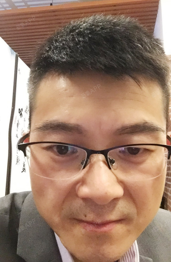 种植眉毛