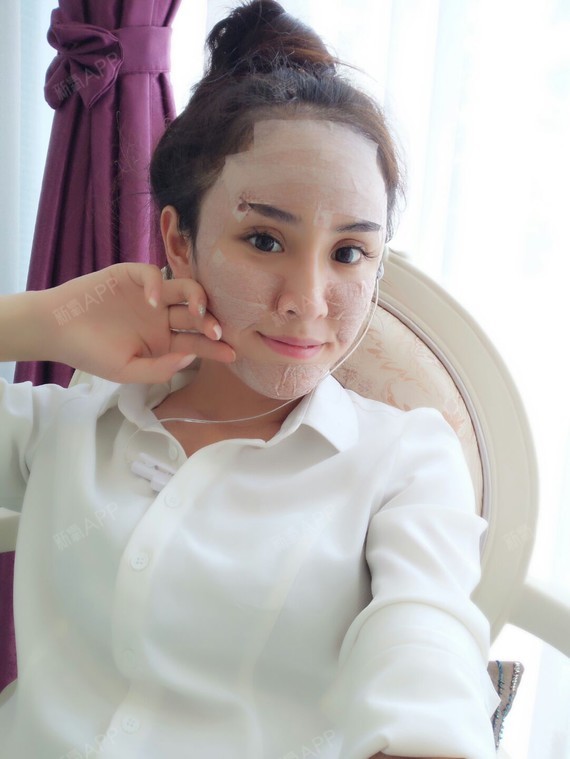 肤白貌美大长腿下一句是自体脂肪全脸填充第3