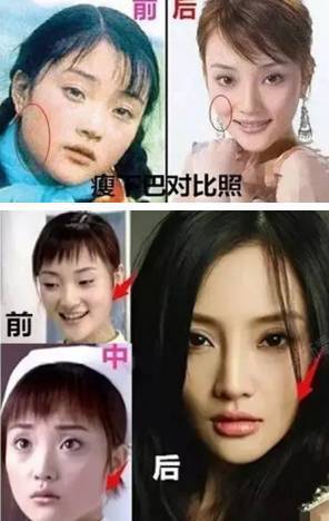 别再说李小璐整容了,现在的她真的美的精致!