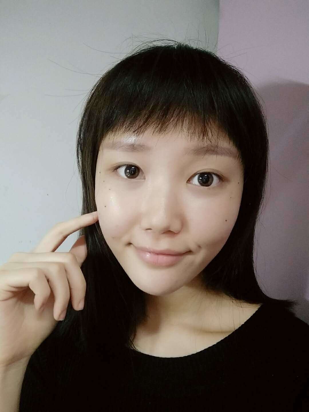 武汉希思特医疗美容医院自体脂肪全脸填充怎么