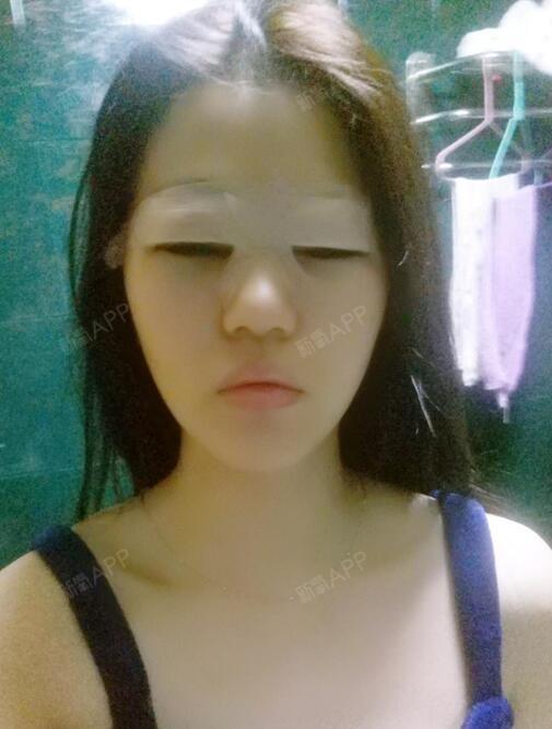 1赶紧十八我要娶她开内眼角第1天美丽日记-新