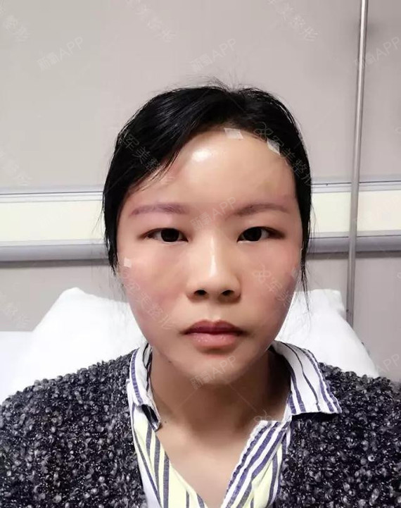 为什么说脂肪是人体软黄金?请看我院员工案