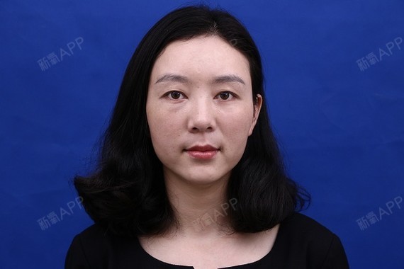 tamny自体脂肪全脸填充第24天美丽日记-新氧美