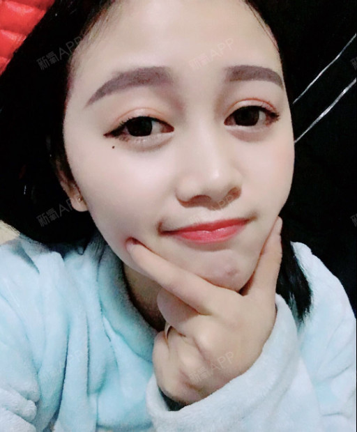 今天是做好定点双眼皮的第50天啦,怀着又开心