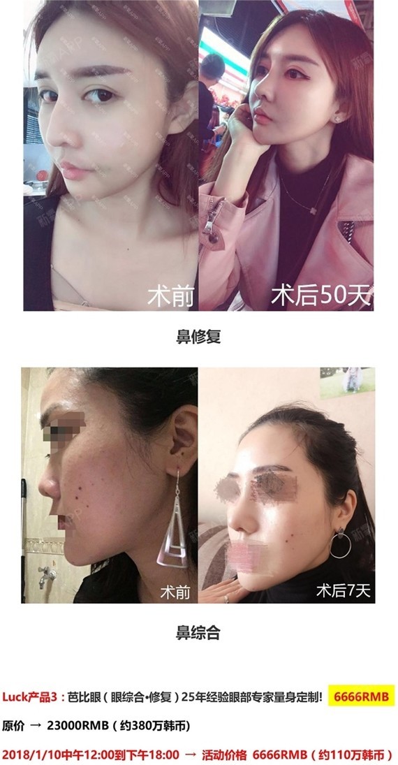 新氧 - 新氧韩国服务站 | 眼部 | 鼻部 | 面部轮廓 | 韩国整形 | 眼部修复 | 鼻部修复 | 自体脂肪填充 新氧 - 新氧韩国服务站 | 眼部 | 鼻部 | 面部轮廓 | 韩国整形 | 眼部修复 | 鼻部修复 | 自体脂肪填充