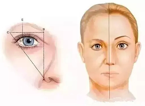 女人随着年龄的增长,眼睛是最先开始显老的部