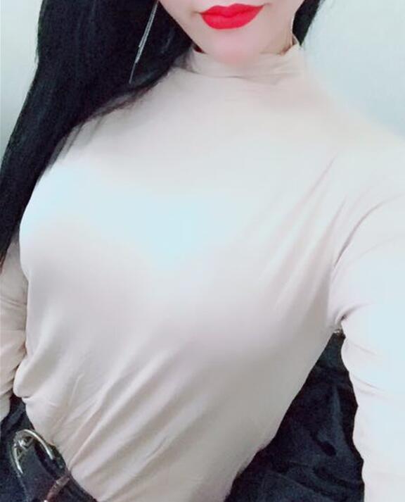 假体隆胸第31天