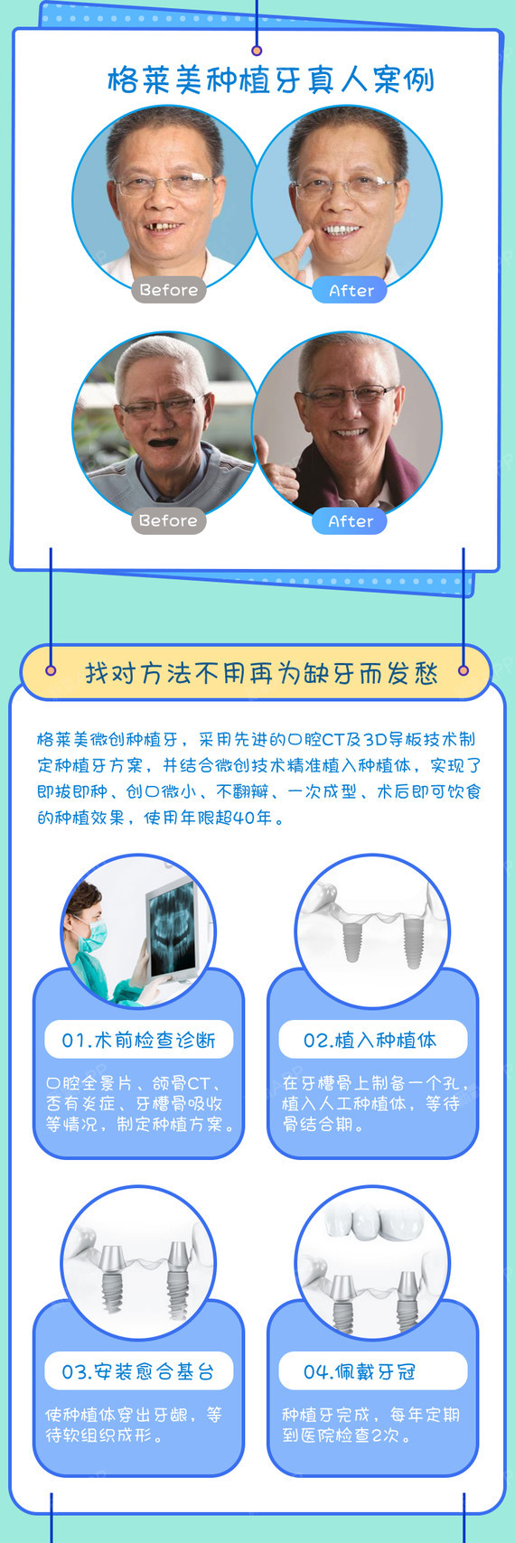 【种植牙】【进口韩系微创种植牙1颗】重建牙齿的健康