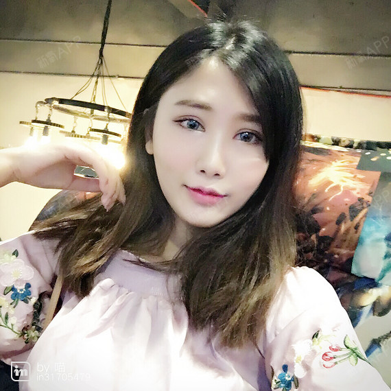 太阳雪1自体脂肪全脸填充第195天美丽日记-新