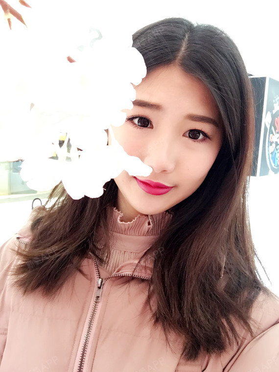 太阳雪1自体脂肪全脸填充第195天美丽日记-新